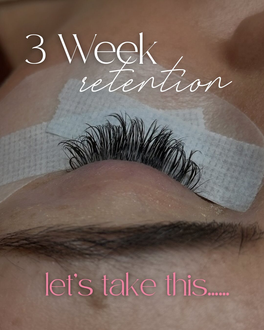 Lash extension retention at three weeks and after a fill, before
